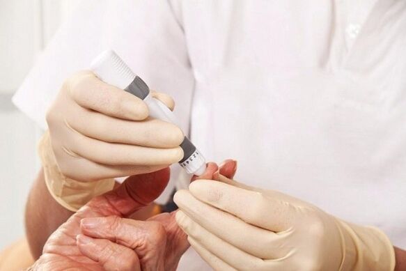 Kraujo tvora cukraus matavimui diabetui